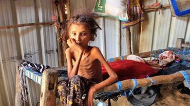 البنك الدولي: الفقر في اليمن زاد بأكثر من النصف خلال سنوات الحرب